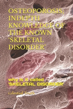 Paperback Osteoporosis; Indepth Knowledge of the Known 'Skeletal Disorder': why Is it called 'SKELETAL DISORDER' Book