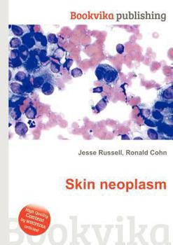 Paperback Skin Neoplasm Book
