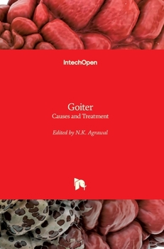 Hardcover Goiter: Causes and Treatment Book