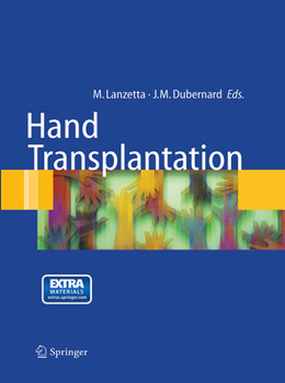 Paperback Hand Transplantation Book