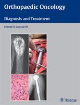 Hardcover Orthopaedic Oncology: Diagnosis and Treatment Book