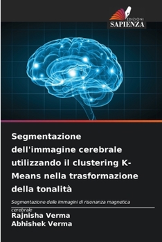 Segmentazione dell'immagine cerebrale utilizzando il clustering K-Means nella trasformazione della tonalità: Segmentazione delle immagini di risonanza magnetica cerebrale (Italian Edition)