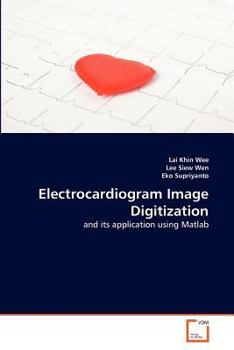Paperback Electrocardiogram Image Digitization Book