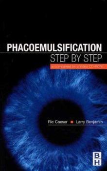 Paperback Phacoemulsification: Step by Step: Accompanied by a Video CD-ROM Book