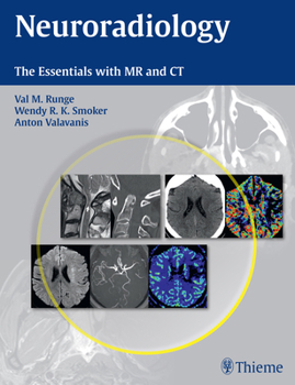 Paperback Neuroradiology: The Essentials with MR and CT Book