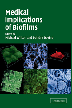 Paperback Medical Implications of Biofilms Book