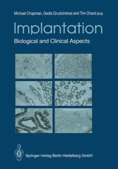 Paperback Implantation: Biological and Clinical Aspects Book