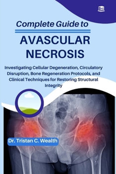 Paperback Complete Guide to Avascular Necrosis: Investigating Cellular Degeneration, Circulatory Disruption, Bone Regeneration Protocols, and Clinical Technique Book