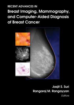 Hardcover Recent Advances in Breast Imaging, Mammography, and Computer-Aided Diagnosis of Breast Cancer Book