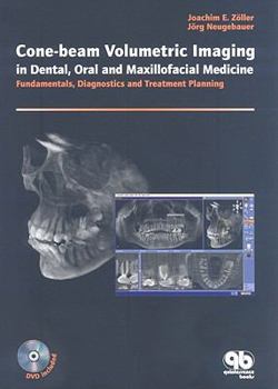 Hardcover Cone-beam Volumetric Imaging in Dental, Oral and Maxillofacial Medicine: Fundamentals, Diagnostics and Treatment Planning Book