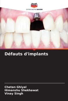 Paperback Défauts d'implants [French] Book