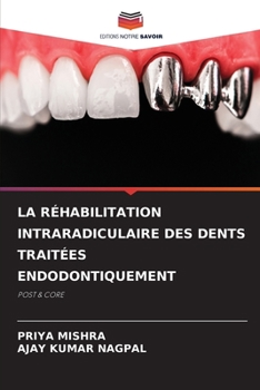 Paperback La Réhabilitation Intraradiculaire Des Dents Traitées Endodontiquement [French] Book