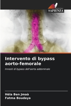 Paperback Intervento di bypass aorto-femorale [Italian] Book