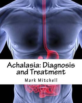 Paperback Achalasia: Diagnosis and Treatment Book