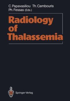 Paperback Radiology of Thalassemia Book