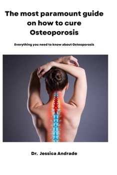 The most paramount guide on how to cure Osteoporosis: Everything you need to know about Osteoporosis