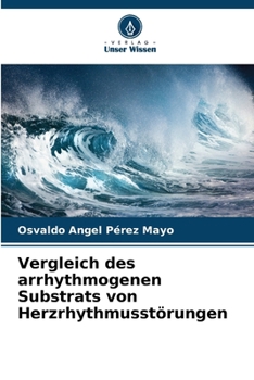 Paperback Vergleich des arrhythmogenen Substrats von Herzrhythmusstörungen [German] Book
