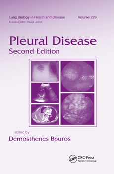 Paperback Pleural Disease Book