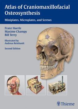 Hardcover Atlas of Craniomaxillofacial Osteosynthesis: Microplates, Miniplates, and Screws Book