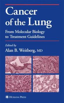 Hardcover Cancer of the Lung: From Molecular Biology to Treatment Guidelines Book