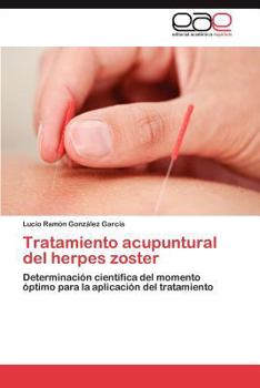 Paperback Tratamiento Acupuntural del Herpes Zoster [Spanish] Book