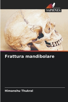 Paperback Frattura mandibolare [Italian] Book
