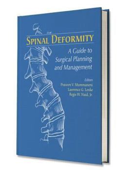 Spinal Deformity: A Guide to Surgical Planning and Management