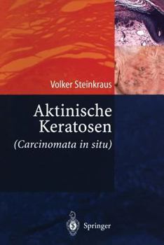 Paperback Aktinische Keratosen (Carcinomata in Situ) [German] Book