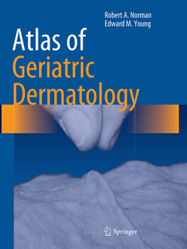 Paperback Atlas of Geriatric Dermatology Book