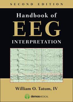 Paperback Handbook of Eeg Interpretation Book