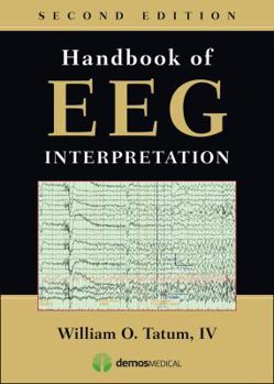 Paperback Handbook of Eeg Interpretation, Second Edition Book