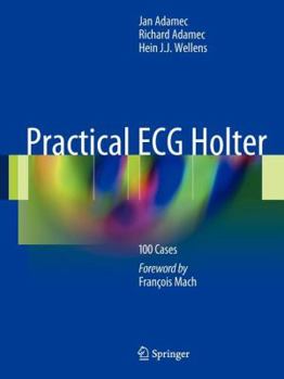 Paperback Practical ECG Holter: 100 Cases Book