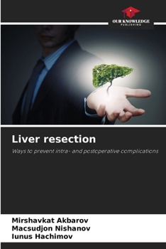 Paperback Liver resection Book