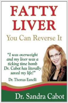 Paperback Fatty Liver: You Can Reverse It Book