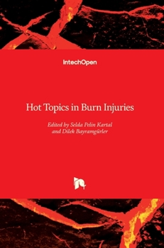 Hardcover Hot Topics in Burn Injuries Book