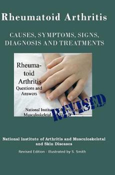 Paperback Rheumatoid Arthritis: Causes, Symptoms, Signs, Diagnosis and Treatments - Revised Edition - Illustrated by S. Smith Book