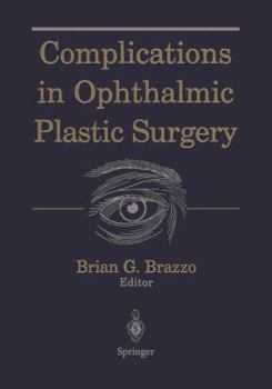 Paperback Complications in Ophthalmic Plastic Surgery Book