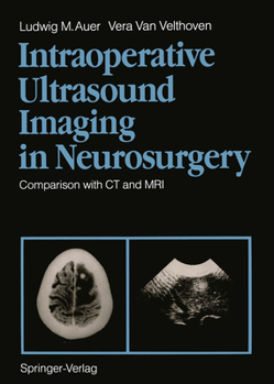 Paperback Intraoperative Ultrasound Imaging in Neurosurgery: Comparison with CT and MRI Book