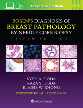 Hardcover Rosen's Diagnosis of Breast Pathology by Needle Core Biopsy Book