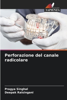 Paperback Perforazione del canale radicolare [Italian] Book