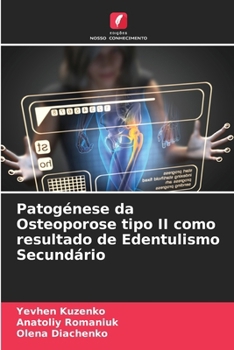 Paperback Patogénese da Osteoporose tipo II como resultado de Edentulismo Secundário [Portuguese] Book