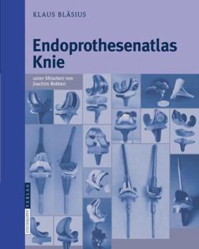 Spiral-bound Endoprothesenatlas Knie [German] Book