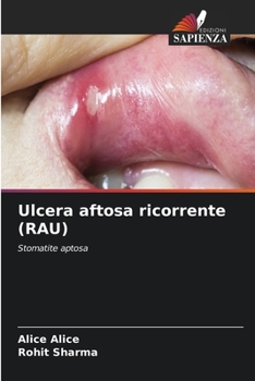 Paperback Ulcera aftosa ricorrente (RAU) [Italian] Book