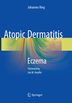 Paperback Atopic Dermatitis: Eczema Book