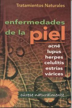 Paperback Tratamientos Naturales Para Enfermedades de la Piel = Natural Treatments for Skin Diseases [Spanish] Book