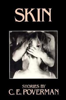 Hardcover Skin: Stories Book