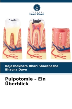 Paperback Pulpotomie - Ein Überblick [German] Book