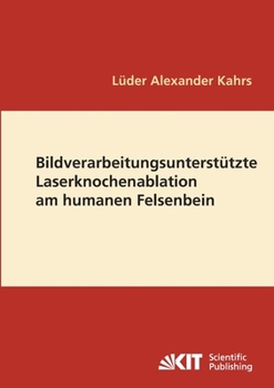 Paperback Bildverarbeitungsunterstützte Laserknochenablation am humanen Felsenbein [German] Book