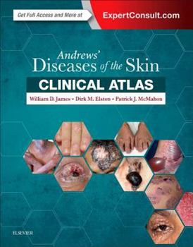 Hardcover Andrews' Diseases of the Skin Clinical Atlas Book