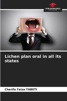 Lichen plan oral in all its states